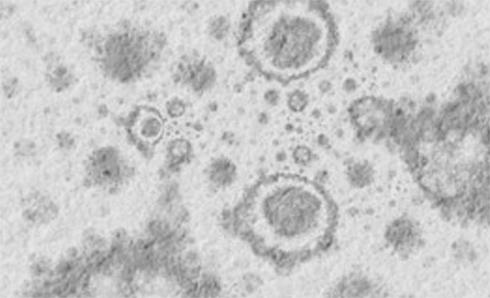 Antimicrobial mildew stains